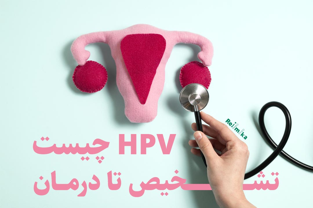 درمان زگیل تناسلی و درمان hpv